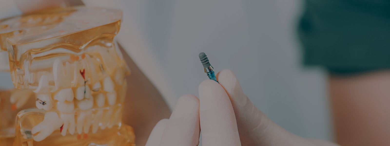 Implantes dentales en adultos mayores