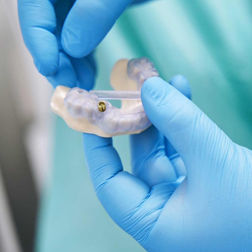 Implantes dentales en adultos mayores